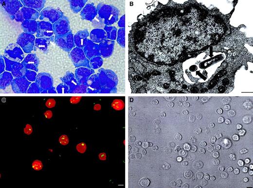 Fig. 5. Partially differentiated 5d-HSCs internalize bacteria. / (A) Phagocytosed L monocytogenes in 5d-HSCs (arrows; Giemsa staining at 1 hour after infection; bar, 10 μm). (B) Transmission electron microscopy reveals phagosomal bacteria (arrows) at 1 hour after infection (bar, 0.6 μm). (C) Fluorescence microscopic image. Detection of CD14+ partially differentiated HSCs (stained with anti–CD14-PE antibodies) and superimposed, intracellular green fluorescent L monocytogenes (yellow) carrying thegfp gene under control of the constitutively activesod promotor (1 hour after infection; bar, 10 μm). (D) Light microscopic image of the identical field (bar, 10 μm).