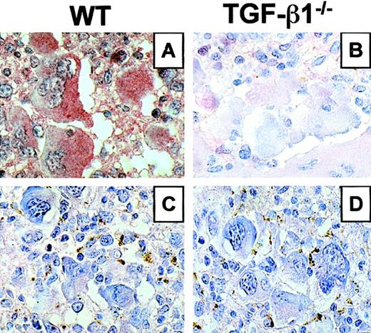 Fig. 4. TGF-β expression in spleen section from mice engrafted with WT or TGF-β1−/−virus–infected hematopoietic cells. / Immunocytochemistry using a TGF-β–specific antibody (A,B). Immunostaining specificity was checked by omitting the primary antibody (C,D). Representative sections are shown at 3 months after transplantation. (A) Mouse engrafted with WT cells showing strong positivity in MK and granulocytes. (B) Mouse engrafted with TGF-β1−/− cells showing no immunoreactivity. (C,D) No immunostaining was revealed when the primary antibody was omitted. Original magnification, × 600 for all panels.