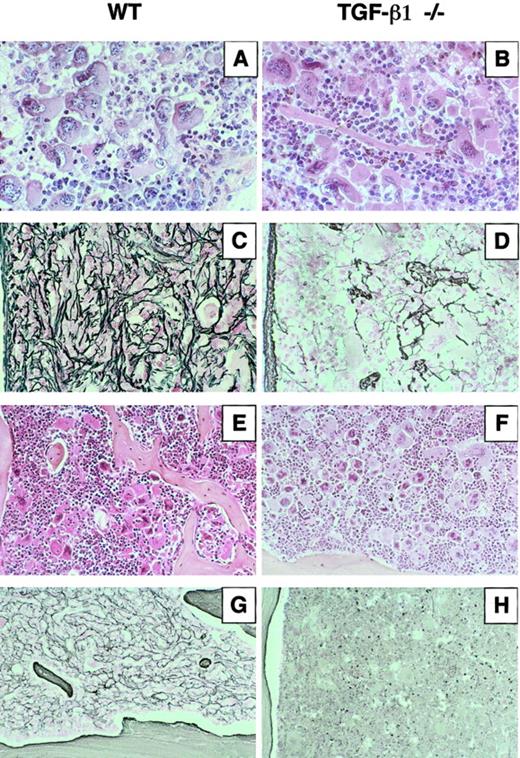 Fig. 5. Histologic sections of spleen and femur from mice engrafted with WT or TGF-β1−/− virus–infected hematopoietic cells. / Three mice in each group (WT5, WT8, WT14 and KO8, KO11, KO14) were killed 4 months after transplantation. Representative sections are shown. Spleen sections stained by hematoxylin and eosin from (A) WT5 engrafted with TGF-β1+/+ cells and (B) KO14 engrafted with TGF-β1−/− cells show the hyperplasia of megakaryocytes and granulocytes. Silver staining revealed massive fibrosis in spleen sections from WT5 (C), whereas no significant reticulin deposition was detected in KO14 (D). Longitudinal femur sections stained by hematoxylin and eosin from WT5 (E) show the growth of new bone trabeculae within the marrow cavity and from KO14 (F) where no bone growth was detected. Silver staining of a femur section from WT5 (G) showing myelofibrosis and from KO14 (H) shows no deposition of reticulin fibers. Original magnifications: A-D, × 400; E-H, × 250.