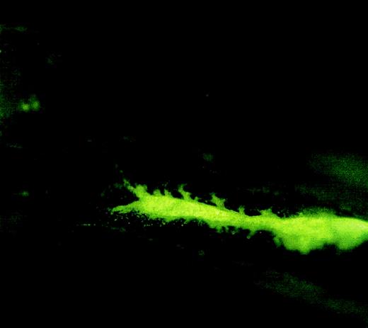 Fig. 2. Fluorescence microscopic picture of a femur longitudinal section showing the location of injected cells in the femur cavity. / Lin− cells were labeled with carboxyfluorescein diacetate, succinimidyl ester (CFDA) and injected into a femur cavity by a 26-gauge needle. The needle insertion hole was sealed with bone wax. The mouse was killed 5 minutes after injection, and the injected femur was removed for fluorescence microscopic analysis. Original magnification, 2 × 20.