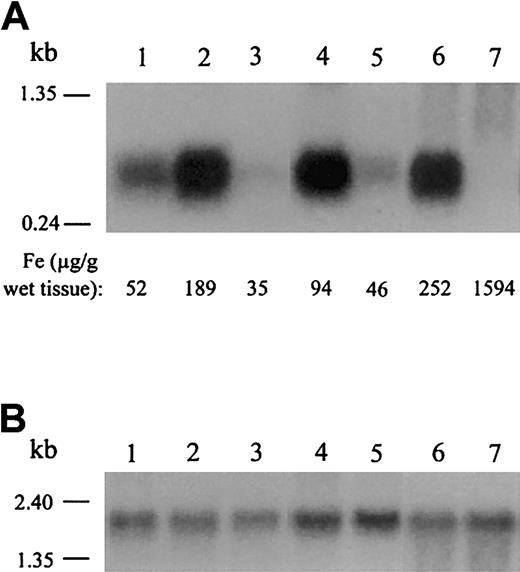 Fig. 2. Northern analysis of hepcidin mRNA expression in mouse models of anemia. / Northern analysis of hepcidin (A) and β-actin (B) expression in mouse liver tissue. Quantitative measurements of nonheme liver iron are recorded for each mouse at the bottom of panel A. We determined β-actin expression to normalize for RNA loading. Hepcidin mRNA expression in livers of C57BL/6J mice (lane 1) was less than that of 129/SvEvTac mice (lane 2). This result is consistent with the observation that wild-type 129/SvEvTac mice generally have higher iron stores than wild-type C57BL/6J mice. Anemic sla/Y mice (lane 3) have low liver iron stores and low hepcidin levels when compared with wild-type mice of the same background strain (C57BL/6J; lane 1). Nonanemic mk/+ mice (lane 4) have more liver iron and express more hepcidin than anemic mk/mk homozygotes (lane 5), which have low iron stores and microcytic anemia. Homozygoushpx/hpx mice cannot efficiently deliver iron to developing red blood cells, resulting in severe anemia despite tissue iron overload (1594 μg iron per gram of liver). These mice have decreased hepcidin mRNA expression (lane 7) when compared with nonanemic littermates (lane 6). These results are representative of 2 experiments without significant variation between experiments.