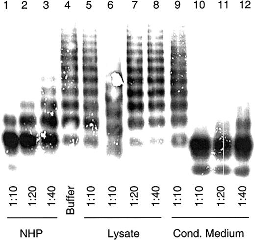 Fig. 3. VWF-cleaving protease activity in lysates and conditioned media of cells transiently expressing ADAMTS13. / Diluted lysates and conditioned media from transfected HEK 293 cells were activated with BaCl2 and incubated with 2.5 μg VWF. NHP dilutions were used for assay calibration. Multimeric analysis of VWF was carried out by SDS gel electrophoresis in 1% agarose gels, and VWF was detected by immunostaining. Sample dilutions are indicated. VWF-cp assay was carried out with cell lysates (lanes 6-8) and conditioned medium (lanes 10-12) from transfections with plasmid pCMV/VWF-cp and the control vector (lanes 5 and 9) and with NHP (lanes 1-3) and buffer (lane 4) as probes.