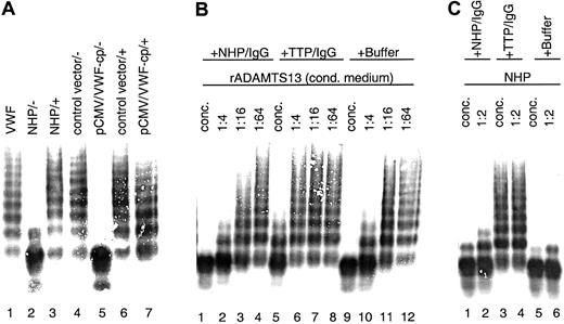 Fig. 5. Inhibition of rADAMTS13 activity by TTP patient plasma containing antibodies neutralizing VWF-cp activity. / VWF-cp assay mixtures were loaded onto an SDS-1% agarose gel, and the VWF multimer pattern was detected by immunostaining. (A) Inhibitory TTP patient plasma was added (+) to the samples before dilution (1:20) activation and incubation with VWF. Buffer was used instead of TTP plasma in some samples (−). Samples used were pooled NHP (lanes 2 and 3), conditioned medium derived from transfections using the vector control (lanes 4 and 6), and VWF-cp expression vector (lanes 5 and 7). VWF-substrate is shown in lane 1. (B) Purified IgG derived from pooled NHP or acquired TTP patient plasma and buffer as control was mixed with conditioned medium containing rADAMTS13 either concentrated (lanes 1, 5, 9) or diluted 1:4 (lanes 2, 6, 10), 1:16 (lanes 3, 7, 11), or 1:64 (lanes 4, 8, 12). (C) NHP was incubated directly (lanes 1, 3, 5) or diluted 1:2 (lanes 2, 4, 6) with purified IgG from NHP or inhibiting TTP patient plasma and buffer.