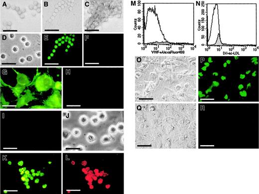 Fig. 4. CD34+FGFR+ cells give rise to endothelial cells in culture. / CD34+FGFR+ cells grow in small groups (A), beadlike strings (B), or clusters (C) of small round cells, similar in size to freshly isolated cells (D). Cultured cells treated with rabbit antihuman VWF IgG and secondary goat antirabbit FITC IgG show expression of VWF (E), whereas those treated with control IgG in place of antibodies to VWF do not stain (F). To ensure the specificity of VWF staining, HUVECs and K562 cells were used as positive and negative controls, respectively. HUVECs display positive staining with VWF IgG (G) and no staining with control IgG (H), whereas no expression of VWF (I) is observed in K562 cells (J). Cultured CD34+FGFR+ cells that express VWF (K) also incorporate DiI-ac-LDL (L). Freshly isolated CD34+FGFR+ cells neither express VWF (M, shaded histogram) nor incorporate ac-LDL (N, shaded histogram). Open histograms represent control histograms, ie, cells incubated in the absence of antibodies to VWF (M) or in the absence of DiI-ac-LDL (N). CD34+FGFR+ (O,P) and CD34+FGFR− (Q,R) cells were cultured on OP9 feeder layers in the presence of FGF-2 and VEGF. Wells seeded with CD34+FGFR+ cells contained substantial numbers of adherent VE-cadherin–expressing cells (P), whereas cells in wells containing CD34+FGFR− cells lacked expression of VE-cadherin (R). Phase contrast microscopy of the same fields is shown in O and Q. Scale bars = 20 μm for panels A-L and O-R.