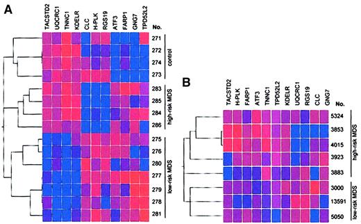 Fig. 2. Identification of genes expressed in CD34+ marrow cells that can distinguish between patients with low-risk MDS, those with high-risk MDS, and healthy controls. / (A) Results represent analysis by hierarchical clustering with Spearman confidence correlation of 15 samples of CD34+ bone marrow cells (training set). Eleven genes were selected to predict the class membership of each of the samples. Vertical list is each of the samples. Horizontal list displays the 11 genes. (B) Validation of the 11 predictive genes used to distinguish between high-risk and low-risk MDS by gene expression profiling. The 11 predictive genes were used for clustering analysis in a second data set obtained from CD34+ cells from patients with low-risk and high-risk MDS (test set). Two clusters corresponding to the IPSS classifications high-risk and low-risk were found. No misclassification of any of the samples of the test set occurred, demonstrating the power of the selected genes for risk group prediction. One high-risk sample, however, was classified in a separate subcluster (sample 3883). Blue indicates low expression; red, high expression. Intensity of the color reflects the reliability of the expression data.