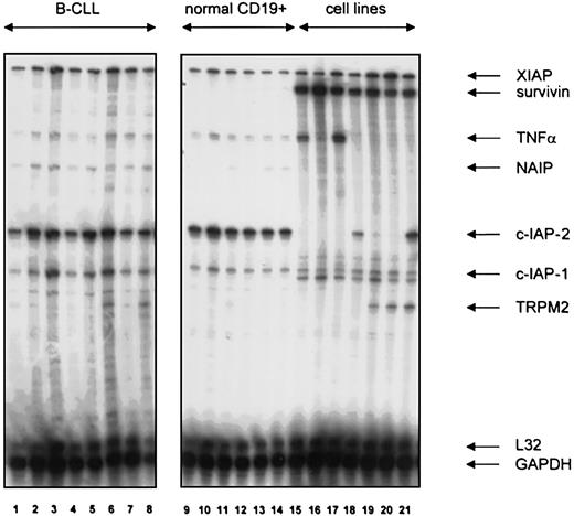 Fig. 1. IAP gene family expression in normal and neoplastic B cells. / Expression of XIAP, survivin, NAIP, c-IAP-1, c-IAP-2, and TRPM2 mRNA in B lymphocytes from patients with B-CLL (lanes 1-8), healthy blood donors (lanes 9-14), the human B-cell precursor lines MHH-CALL2 (lane 15), MHH-CALL3 (lane 16), MHH-CALL4 (lane 17,) and the human myeloma cell lines LP-1 (lane 18), OPM-2 (lane 19), NCI-H929 (lane 20), and RPMI-8226 (lane 21). A hAPO-5c RNAse protection assay with an added TNFα template provided by the manufacturer was used. A quantity of 10 μg total RNA was used per lane.