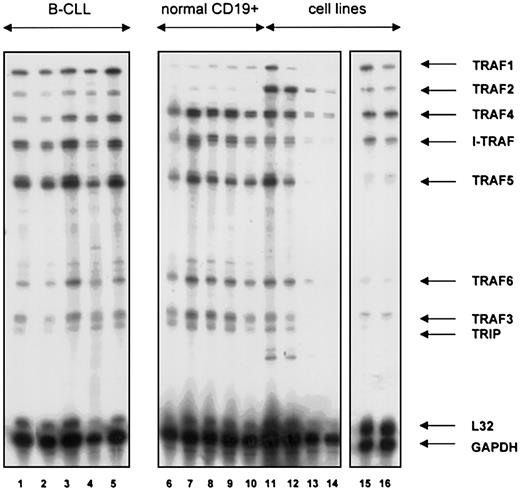 Fig. 2. TRAF gene family expression in normal and neoplastic B cells. / Expression of TRAF1-6, I-TRAF, and TRIP mRNA in B lymphocytes from patients with B-CLL (lanes 1-5), healthy blood donors (lanes 6-10), a tonsil specimen (lane 11), the human B-cell precursor lines MHH-CALL 2 (lane 12) and MHH-CALL4 (lane 13), the human T-cell leukemia line MOLT4 (lane 14), the CD5+, EBV+ B-cell line EHEB (lane 15), and the EBV-Burkitt cell line BJAB (lane 16). A hAPO-5b RNAse protection assay was used for all experiments. A quantity of 10 μg total RNA was used per lane.