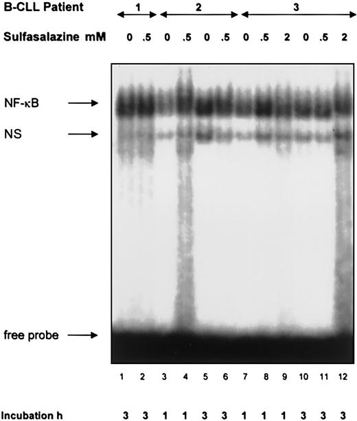 Fig. 7. Lack of an inhibitory effect of sulfasalazine on NF-κB/Rel DNA binding in CLL lymphocytes. / Electrophoretic mobility shift assays were performed with nuclear extracts from B cells of patients with B-CLL and the labeled H2TF1 binding site as a probe. B-CLL lymphocytes were incubated with sulfasalazine at the indicated concentrations and times before extraction of nuclear proteins. The specific NF-κB/Rel binding complexes are indicated by an arrow. NS corresponds to nonspecific binding. Extracts from neoplastic lymphocytes of 11 patients incubated for 1 hour to 17 hours consistently failed to indicate an inhibitory effect of sulfasalazine.