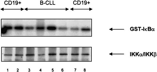 Fig. 8. IκB Kinase (IKK) activity and expression in normal B cells and B-CLL lymphocytes. / IKK activity (upper panel) and protein expression (lower panel) were similar in normal CD19+ B cells (lanes 1, 2, 7, 8) and B-CLL lymphocytes (lanes 3-6). An IκB substrate mutated at positions 32 and 36 was not phosphorylated (data not shown).
