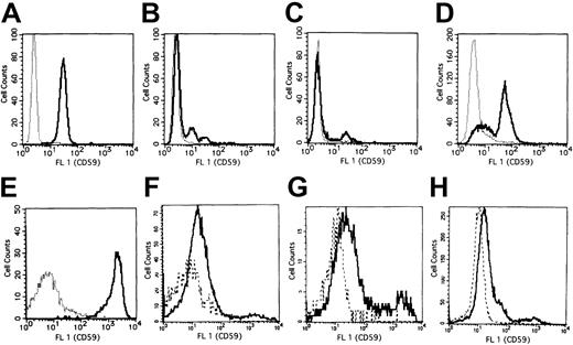 Fig. 3. Flow cytometric profiles of CD59 expression on peripheral blood granulocytes and bone marrow CD34+ cells from 3 PNH patients and a healthy volunteer. / In each histogram, thick and thin lines in panels A-D or solid and dashed lines in panels E-H show reacted samples and negative controls, respectively. Horizontal and vertical axes are fluorescence intensity of CD59 (FL1) and cell counts, respectively. (A) Granulocytes from a healthy volunteer. (B) Granulocytes from case 1. (C) Granulocytes from case 2. (D) Granulocytes from case 3. (E) CD34+ cells from a healthy volunteer. (F) CD34+cells from case 1. (G) CD34+ cells from case 2. (H) CD34+ cells from case 3.
