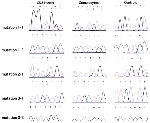 Fig. 4. Direct sequence analyses of PCR-amplified PIG-A DNA in CD59-deficient CD34+ cells and granulocytes and in CD59+granulocytes from PNH patients. / Direct sequence analyses of PCR-amplified PIG-A DNA from bone marrow CD34+ cells or peripheral blood granulocytes from 3 PNH patients and a healthy volunteer were performed as described in “Patients, materials, and methods.” The results, with controls for each mutation shown in the right column, were obtained by analyses of PIG-A DNA in CD59+ populations of peripheral blood granulocytes from the PNH patients. Normal and mutated alleles are presented above each graph in the upper and lower rows, respectively.