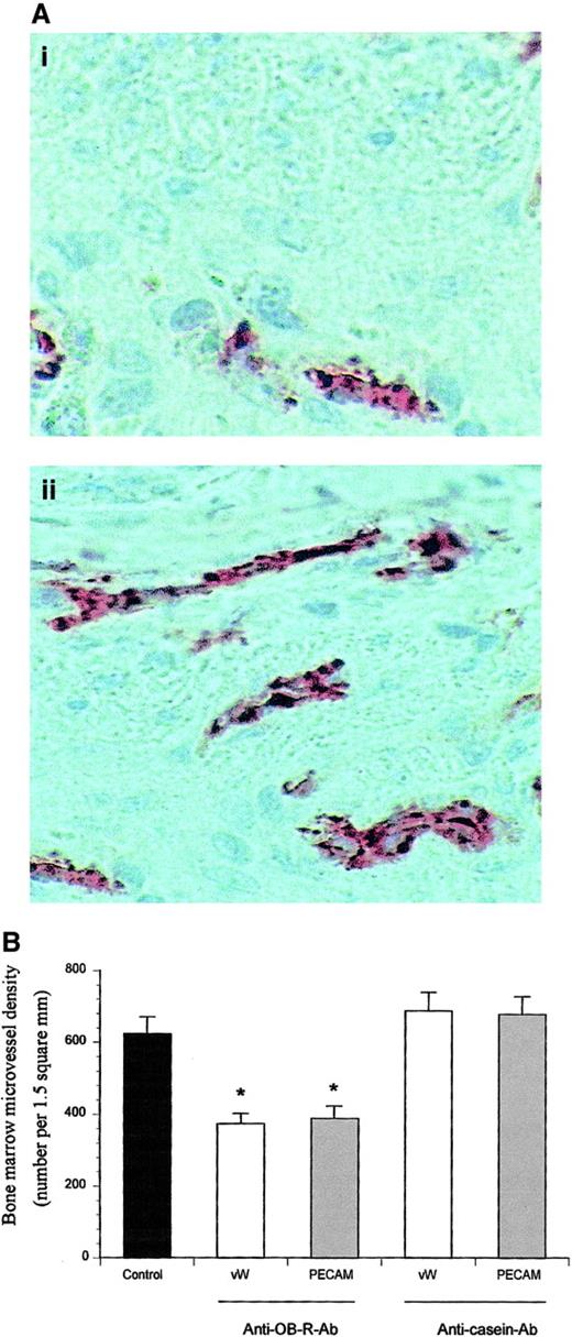 Fig. 2. Reduced bone marrow angiogenesis in leukemic rats treated with anti–OB-R, but not with anticasein mAb. / (A) Representative fields of histologic cross sections from bone marrow of a healthy (i) and a leukemic (ii) rat. The microvessels were identified with an anti–von Willebrand mAb (red stain). Note the higher microvessel density in leukemic versus normal marrow. Magnification × 500. (B) Pooled data of leukemic rats treated with saline (control) or with anti–OB-R or anticasein mAb. Values are based on staining with an anti-VWF mAb and an anti-PECAM mAb, and presented as means + SEM; n = 8 rats; *P < .05 compared with control.