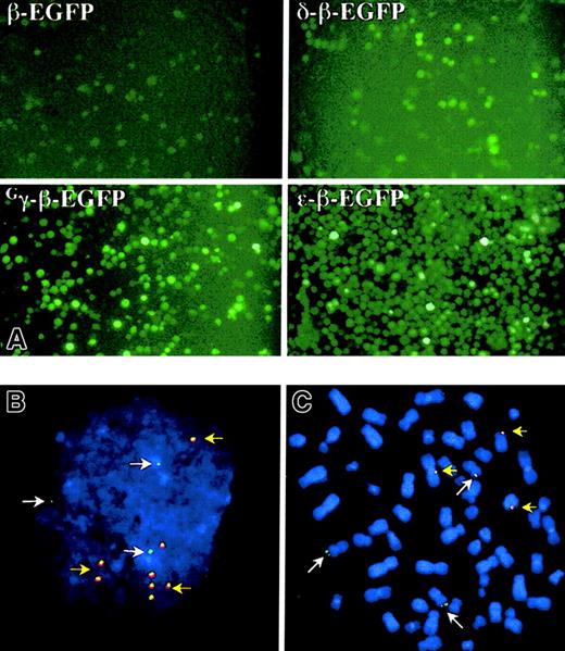 Fig. 3. Fluorescent microscopy of K562-EBNA1 cells episomally transfected with the EGFP-modified globin EBACs. / Pools of transfected K562-ENBA-1 cells were cultured for 40 days in the presence of hygromycin before examination. (A) Direct examination of EGFP expression after transfection with 4 different EGFP constructs, as indicated. Original magnification × 200. (B-C) Fluorescent in situ hybridization analysis of K562-EBNA1 cells episomally transfected with the Gγ-β-EGFP globin EBAC. Cell spreads were probed with the β-globin EBAC (green) and pEBAC160 vector (red). DNA was counterstained with DAPI. Most cells contained 3 single green signals (white arrows), which correspond to the 3 copies of chromosome 11. Typical interphases (B) and metaphases (C) were found to contain 5 ± 3 colocalized signals for red and green (yellow arrows), that were intimately associated with single chromatids in metaphases. Original magnification B-C, × 400.