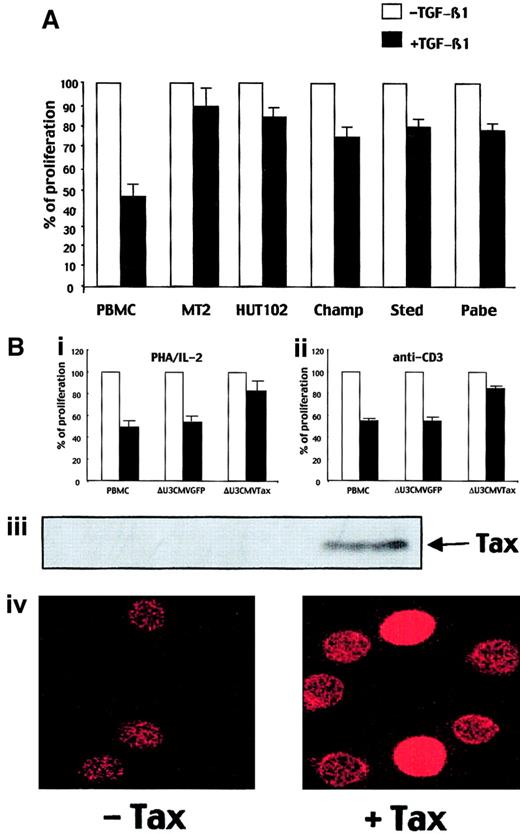 Fig. 1. IL-2–dependent ATL cells and HTLV-1–transformed cell lines are resistant to the TGF-β1–induced growth inhibition. / (A) PBMCs, MT2 and HUT102 cell lines, and IL-2–dependent fresh ATL cells from patients (Champ, Sted, Pabe) were stimulated with PHA (1 μg/mL) and IL-2 (10 IU/mL) in the presence or in the absence of TGF-β1 (2 ng/mL) for 72 hours, and their proliferation was determined as described in “Materials and methods.” The results are representative of 3 independent experiments, each conducted in triplicate. (B) PBMCs and ΔU3CMVGFP- or ΔU3CMVTax-transduced PBMCs were stimulated with either PHA/IL-2 (i) or anti-CD3 (100 ng/mL; ii) in the presence or in the absence of TGF-β1 (2 ng/mL) for 72 hours and their proliferation was determined as described in “Materials and methods.” The results are representative of 3 independent experiments, each conducted in triplicate. Tax expression in ΔU3CMVTax-transduced PBMCs, as compared with ΔU3CMVGFP or untransduced PBMCs, is detected with an anti-Tax antibody by immunoblot assay (iii) or immunofluorescence (iv). Original magnification Biv, × 40.