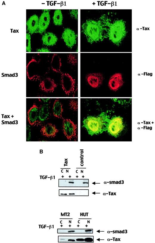 Fig. 5. Tax neither impairs TGF-β1–induced Smad3 nuclear accumulation nor modifies Smad3 expression. / (A) HeLa cells were transfected with Flag-Smad3 and Tax expression vectors and were incubated either in the absence or in the presence of TGF-β1 for 30 minutes. Flag-Smad3 was visualized with an anti-Flag antibody, and Tax was detected with a rabbit anti-Tax antibody. Localization of the indicated proteins was analyzed by confocal immunofluorescence microscopy. Original magnification × 100. (B) HepG2 cells were transfected with Tax expression vector (Tax) or an empty expression vector (control) and treated with TGF-β1 for 1 hour. HepG2, MT2, and HUT nuclear (N) and cytoplasmic (C) lysates were subjected to immunoblot analysis with a polyclonal rabbit anti-Smad3 antibody and a mouse anti-Tax monoclonal antibody.