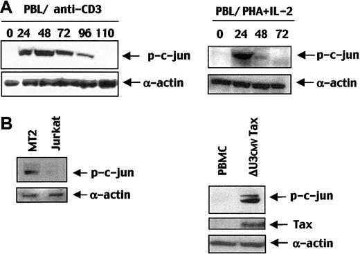 Fig. 8. Tax induces constitutive JNK activation and p-c-Jun up-regulation in peripheral T cells and in HTLV-1–transformed cell line MT2. / (A) Peripheral T cells were stimulated with anti-CD3 (100 ng/mL), and PBMCs were stimulated with PHA/IL-2 and were harvested at the indicated times. Lysates were subjected to immunoblot probed with an anti–p-c-Jun antibody. (B) p-c-Jun and Tax expression were detected by an anti–p-c-Jun and anti-Tax antibodies using immunoblot analysis with total lysates of Jurkat or MT2 cell lines, ΔU3CMVTax-transduced or -untransduced PBMCs.