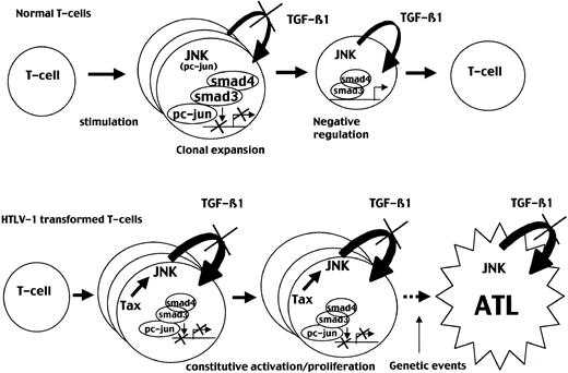 Fig. 9. JNK activation is transient in normal T cells but constitutive in ATL cells leading to permanent TGF-β1 resistance. / (Top) Stimulation of normal peripheral T cells induces JNK activity, leading to TGF-β1 production and preventing TGF-β1 inhibition through the induction of a Smad3/c-Jun complexes. This period may allow clonal expansion and triggering of the immune response. In normal T cells, JNK activation is transient and decreases after 72 to 96 hours, allowing TGF-β1 antiproliferative effect and restoration of a resting state. (Bottom) In contrast, in HTLV-1–transformed cells, Tax induces constitutive JNK activity that may lead to a continuous TGF-β1 resistance, allowing clonal expansion and a constitutively activated state observed in patients infected with HTLV-1. Subsequent oncogenic events associated with TGF-β1 resistance may result in ATL development.
