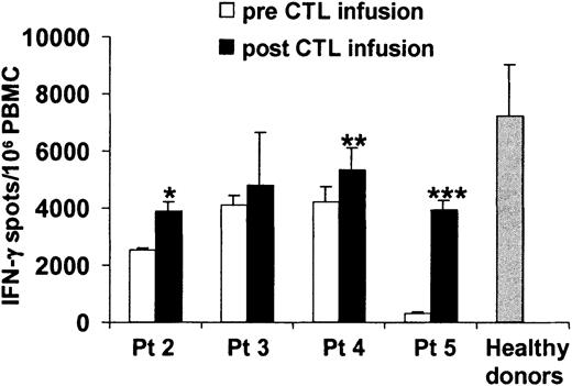 Fig. 4. Evaluation of the frequency of EBV-specific T cells in the peripheral blood of patients infected with CAEBV syndrome before and after adoptive immunotherapy. / The frequency of EBV-specific cells was determined by Elispot assay on PBMCs before (■) and after (▪) CTL infusion. Bars represent the mean numbers ± SD of interferon-gamma spot-forming cells per 106 PBMCs. Data from patient no. 1 were not available. ░ represents the mean ± SD of interferon-gamma spot-forming cells per 106 PBMCs observed in a representative series of normal healthy donors. * indicates P = .01; ** indicatesP = .03; *** indicates P = .002.
