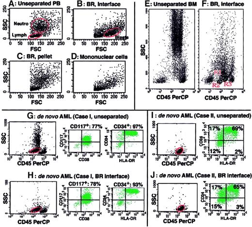 Fig. 1. BR density centrifugation enriches blasts without altering immunophenotype data of blasts. / (A-D) SSC versus FSC display of cell fractions of PB from an MDS patient. PB containing 1.5% blasts (A) was subjected to BR density centrifugation (B-C) or Ficoll-Paque density centrifugation (D). Blasts were markedly enriched in the BR interface (B) but not recovered in the BR precipitate (C). Blast enrichment by Ficoll-Paque density centrifugation was minimal (D). Blast percentages determined in Wright-Giemsa–stained cytospin preparations by examining 100 cells were 63%, 0%, and 5% for panels B, C, and D, respectively. Circles marked as Neutro, Lymph, and Blasts in panels A and B indicate neutrophil, lymphocyte, and blast populations, respectively. (E-F) CD45 versus SSC display of normal BM cells before (E) and after BR density centrifugation (F, the BR interface). Immunophenotyping showed that the predominant cells in R1 were immature myeloid cells (CD34 57%, CD13 49%, CD33 50%) with minor contamination by immature B cells (CD10 22%, CD19 20%), the cells in R2 were stage I immature B cells (CD34 57%, CD10 75%, CD19 87%, CD20 27%, CD13 and CD33 < 15%), and the cells in R3 were stage II immature B cells (CD34 8%, CD10 67%, CD19 71%, CD20 56%, CD13 and CD33 < 15%). (G-J) Samples from 2 de novo AML cases (cases I and II) were subjected to blast immunophenotyping before (G,I) and after BR density centrifugation (H,J). The circles on the CD45 versus SSC display indicate gates for blast immunophenotyping. Immunophenotype data remained unchanged after BR density centrifugation.