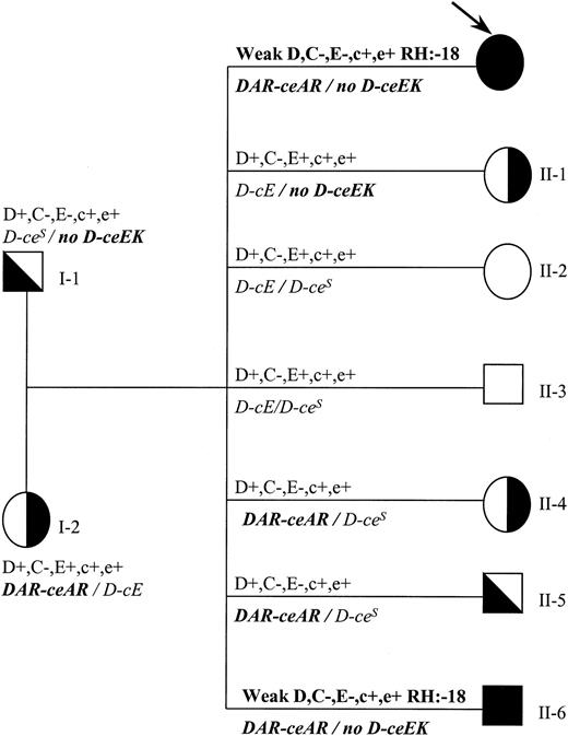Fig. 2. Family tree indicating genotypes and phenotypes for individual 1. / Rh phenotype and genotype (italics) are shown. Propositus is indicated by an arrow. DAR is in linkage with ceAR(indicated as DAR-ceAR), whereas ceEK is not associated with any RHD gene (indicated as no D-ceEK). Propositus and individual II-6 have the same molecular background and the same rare phenotype (RH:−18).