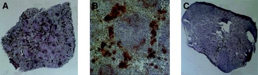 Fig. 5. Megakaryopoiesis in the spleen, day 28 after transplantation. / Megakaryocytes stain dark as a consequence of histochemical staining for acetylcholinesterase. (A) Typical spleen of animal receiving Rholow stem cells. (B) A cluster of megakaryocytes in the perifollicular space after Rholow transplantation. (C) Animals receiving the Rhohigh progenitor have almost no splenic megakaryocyte activity. Original magnification A, × 20; B, × 100; and C, × 20.