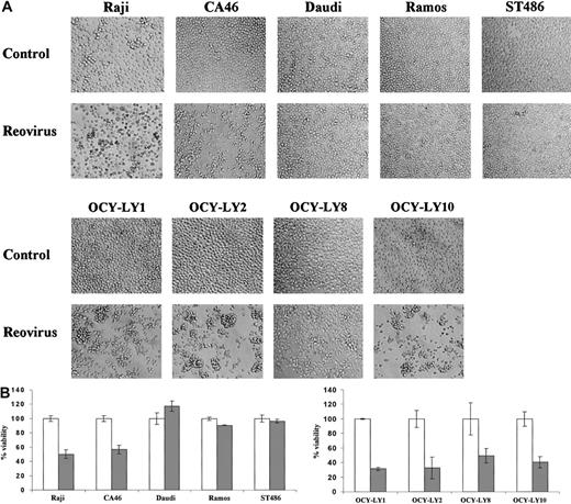 Fig. 1. Effect of reovirus on lymphoma cell lines in vitro. / (A) Reovirus-induced cytopathic effects in various lymphoma cell lines in vitro. Established human Burkitt lymphoma (Raji, CA46, Daudi, Ramos, and ST486) and diffuse large B-cell NHL (OCY-LY1, OCY-LY2, OCY-LY8, and OCY-LY10) cell lines were exposed to reovirus at an MOI of 20 PFUs per cell, and photomicrographs were taken at 96 hours after infection. Cytopathic effects are apparent in all diffuse large B-cell NHL as well as the Raji and CA46 cell lines, but not in Daudi, Ramos, or ST486 cells. Original magnification × 200. (B) Remaining viability. Viability of the same cell lines at 96 hours after infection was assessed by staining the cells with 0.25% trypan blue; unstained (viable) cells from 3 independent wells were counted by means of a hemocytometer. As expected, there is good correlation between cell death and manifestation of the cytopathic effects shown in Figure 1A. ■ indicates control; and ░, reovirus.