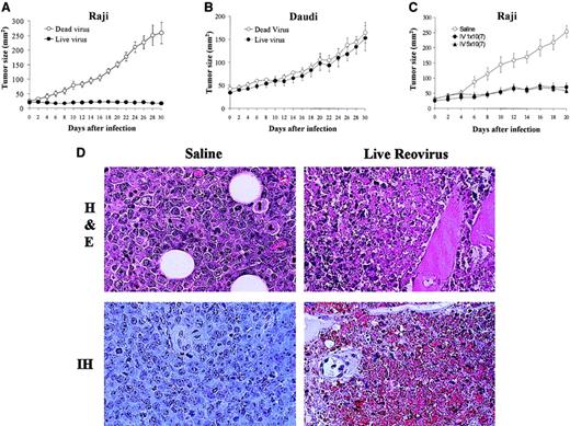 Fig. 3. Effect of reovirus on lymphoid tumors in SCID/NOD mice. / (A-B) Intratumoral reovirus therapy of lymphoid tumors in SCID/NOD mice. SCID/NOD mice were subcutaneously implanted with 1 × 107 cells of either Raji (A) or Daudi (B) Burkitt lymphoma cell lines. Following the establishment of a palpable mass, the tumors received (on day 0) a single intratumoral injection of 1 × 107 PFUs of live reovirus (n = 8; ●) or UV-inactivated virus (n = 7; ○). Tumor growth was followed for a period of 30 days and measured 2-dimensionally with a caliper. (C) Intravenous administration of reovirus to SCID/NOD mice bearing Raji tumors. Animals bearing palpable subcutaneous Raji tumors were subjected (on day 0) to a single intravenous injection of 1 × 107 PFUs (n = 7) or 5 × 107 PFUs (n = 7) of reovirus (● and ▴, respectively). Control animals (n = 7) received saline injection (○). Tumor growth was followed for a period of 20 days and measured 2-dimensionally with a caliper. (D) H&E staining and IH of reovirus antigens in Raji tumors after intravenous reovirus treatment. H&E-stained section (original magnification × 400) shows necrosis of tumor cells 20 days after live reovirus treatment. IH-stained section (original magnification × 400) of remaining tumor cells stains positively for reovirus proteins (brown) while control tumor shows no staining.