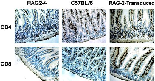 Fig. 3. Intraepithelial lymphocyte development after gene transfer. / CD4 and CD8 immunohistochemical stainings (n = 3) were used to phenotype gut-specific intraepithelial lymphocytes (IEL) from frozen intestine sections of RAG-2−/−, C57BL/6, and RAG-2–transduced mice (6 months after transplantation). CD4+ and CD8+IELs were detected in RAG-2–transduced mice as well as in wild-type C57BL/6 controls. Original magnifications × 200.