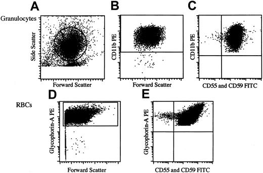 Fig. 1. Protocol for identification of PNH-type granulocytes and RBCs. / (A) Forward and side scatter gates used to define granulocytes. (B) Expression of CD11b by gated cells from panel A. (C) Expression of CD55 and CD59 by CD11b+ granulocytes (defined in panel B) in patient 11. Percentage of PNH-type granulocytes (CD11b+CD55−CD59−granulocytes/total CD11b+ granulocytes) was 0.1%. (D) Glycophorin-A+ cell gate to define RBCs. (E) Expression of CD55 and CD59 by glycophorin-A+ RBCs (defined in panel D) in patient 11. Percentage of PNH-type RBCs (glycophorin-A+CD55−CD59−RBCs/total glycophorin-A+ RBCs) was 0.2%.