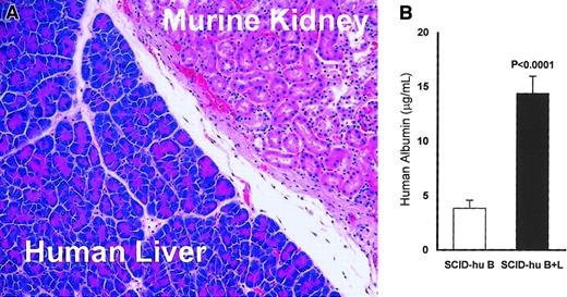 Fig. 1. Viability and activity of the implanted human liver in myelomatous SCID-hu hosts (SCID B+L). / (A) Representative section stained with hematoxylin and eosin shows the human liver tissue adjacent to the murine kidney at the end of experiment 11 (25 weeks after liver transplantation; original magnification × 200). Similar data were obtained for all hosts implanted with human liver. (B) Human albumin levels in the serum of SCID-hu B+L (n = 16) are significantly higher than in SCID-hu B (n = 18) mice (P < .0001). Error bars represent SEMs. Thalidomide had no effect on levels of human albumin in thalidomide-treated hosts (see “Results”).