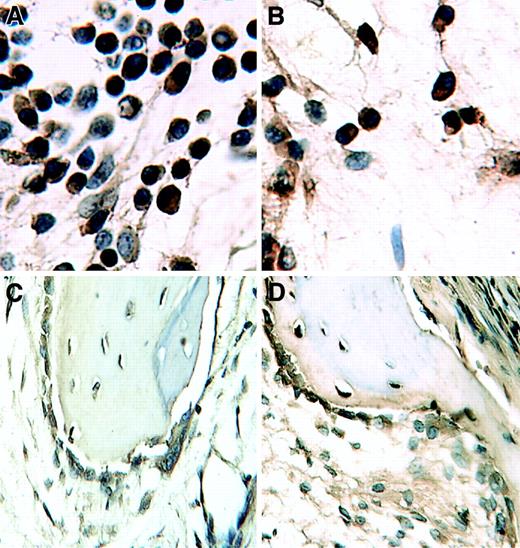 Fig. 6. Response to thalidomide is not associated with reduction of VEGF expression. / Immunohistochemical staining for VEGF in sections of decalcified human bones of SCID-hu hosts showing equal expression in CMC-treated (A,C) and thalidomide-treated (B,D) hosts inoculated with myeloma cells from patient 13; panels A and B show myeloma cells; panels C and D are bone marrow stromal cells.
