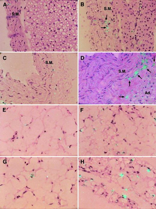Fig. 4. In situ hybridization analysis of TF mRNA in the aortas and adipose tissues of control and stressed mice. / Aortas and epididymal fat tissues were harvested from 8-week-old and 24-month-old mice before and after 20 hours of continuous restraint stress and then analyzed by in situ hybridization as described in “Materials and methods.” The hybridization signal for TF mRNA corresponds to the light blue dots in all panels. (A-D) Aortas of the unstressed (A, 8 weeks old; C, 12 months old) and stressed (B, 8 weeks old; D, 12 months old) mice. Arrows indicate cells that are strongly positive for TF mRNA in the adventitia of aorta. S.M. indicates vascular smooth muscle layer; Ad, adipose tissue around the vessel wall of aorta. (E-H) Epididymal fat tissues of the unstressed (E, 8 weeks old; G, 24 months old) and stressed (F, 8 weeks old; H, 24 months old) mice. All slides were exposed for 10 weeks at 4°C. Original magnification for all panels × 400.