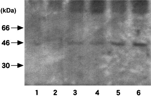 Fig. 6. Western blot analysis of TF antigen in adipose tissues of the stressed obese mice. / Six-week-old male obese mice and their lean counterparts were stressed in restraint tubes for 2 or 20 hours. Mice were killed and epididymal fat tissues were removed and their lysates prepared. Two micrograms of each lysate was loaded on an 8% polyacrylamide gel, and TF antigen was analyzed by Western blotting with the use of polyclonal rabbit antimouse TF antibody. Lanes 1-3, lean mice (1, no stress; 2, 2 hours of stress; 3, 20 hours of stress); lanes 4-6, obese mice (4, no stress; 5, 2 hours of stress; 6, 20 hours of stress). The numbers to the left of the blots indicate molecular weight.
