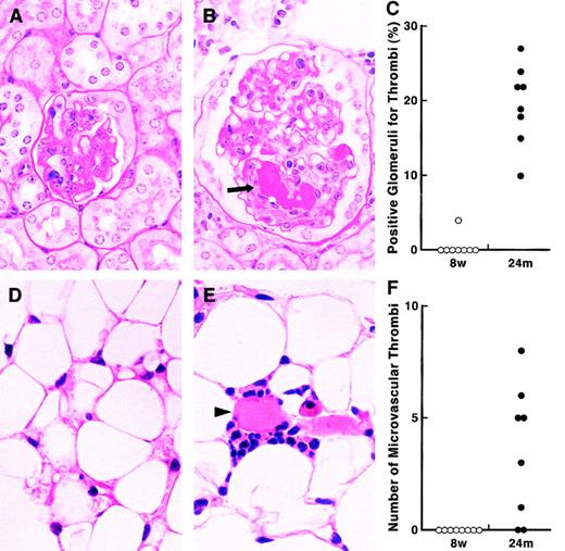 Fig. 7. Stress-induced thrombi formation in tissues of young and aged mice. / Renal and adipose tissues were removed from young (8-week-old) and aged (24-month-old) mice after 20 hours of restraint stress (n = 8 in each age group). Tissue sections were stained with PAS (A-B) or with hematoxylin/eosin (D-E) and examined microscopically. (A-B) Renal glomerulus of the stressed young (A) and aged (B) mice; original magnification, × 1000. An arrow denotes glomerular thrombus in aged mice. (D-E) Epididymal adipose tissues of the stressed young (D) and aged (E) mice; original magnification, × 400. An arrowhead indicates thrombi in the microvessels between adipocytes. Quantitation of stress-induced glomerular thrombi was achieved by counting the positive glomeruli for thrombi of at least 100 glomeruli in each kidney section from young (8w) and aged mice (24m), and the percentage of positive glomeruli for thrombi in each mouse is shown in panel C. Panel F shows each number of thrombi detected in the vasculature within the same size of microscopic area (90 mm2) in epididymal fat tissues of the stressed young (8w) and aged (24m) mice.