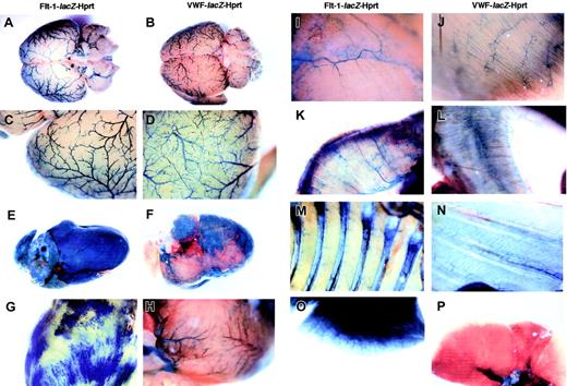 Fig. 3. Comparative whole mount LacZ staining of adult organs from Flt-1-lacZ-Hprt and VWF-lacZ-Hprt mice. / LacZ staining of the adult organs of both lines was performed in parallel. Left column indicates Flt-1-lacZ-Hprt mice. Right column indicates VWF-lacZ-Hprt mice. Low magnification view of brain (A-B), high magnification of brain (C-D), low magnification of heart (E-F), high magnification of heart (G-H), thigh skeletal muscle (I-J), diaphragm (K-L), chest wall (M-N), and lung (O-P).