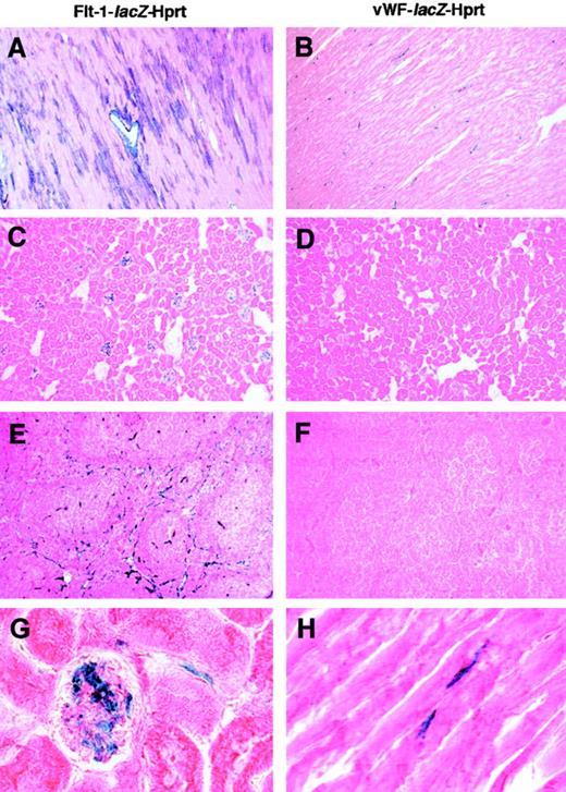 Fig. 4. Comparative LacZ staining of representative sections from Flt-1-lacZ-Hprt and VWF-lacZ-Hprt mice. / LacZ staining of 10 μm tissue sections was performed in parallel. Left column indicates Flt-1-lacZ-Hprt mice. Right column indicates VWF-lacZ-Hprt mice. In Flt-1-lacZ-Hprt hearts, β-galactosidase activity was present in the endothelium and smooth muscle cells of occasional large arteries as well as in cardiomyocytes (A). In VWF-lacZ-Hprt hearts, LacZ expression was detected in the endothelial lining of a subset of capillaries (B,H). Flt-1-lacZ-Hprt mice revealed reporter gene activity in the glomeruli and small arterioles of the kidney (C,G), and in microvessels of the spleen (E). In contrast, the X-Gal reaction product was undetectable in the kidney (D) and spleen (F) of VWF-lacZ-Hprt mice. A-F, × 100 optical magnification; G and H, × 1000 optical magnification.