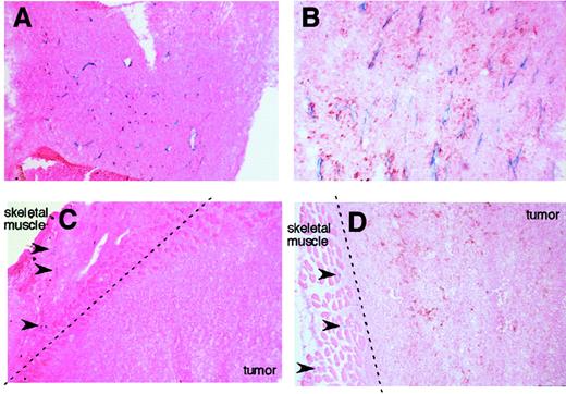 Fig. 5. Comparison of Flt-1 and VWF promoter activity in tumor xenografts. / Uniform and strong LacZ staining was detected in Lewis lung carcinoma (A) and B16-F1 melanoma (B) xenografts from Flt-1-lacZ-Hprt mice. In contrast, there was no detectable reporter gene activity in Lewis lung carcinoma (C) and B16-F1 melanoma (D) xenografts from VWF-lacZ-Hprt mice. Arrowheads indicate the X-Gal reaction product in capillaries of adjacent skeletal muscle. Broken lines indicate the border between tumor layer and adjacent skeletal muscle layer. Photographs were taken at × 100 optical magnification. The results are representative of at least 2 independent experiments.