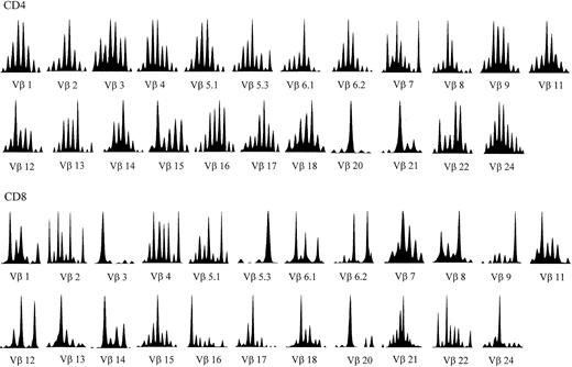 Fig. 1. TCRBV CDR3 spectratyping histograms in a representative A-T patient (no. 2). / The majority of the TCRBVs have altered CDR3 profiles compared to the quasi-gaussian distribution of peaks observed in normal spectratypes (eg, Vβ1 and Vβ24 in this patient). The Vβ nomenclature adopted is from Wei et al.52