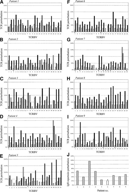 Fig. 2. Diversity of the TCRBV and IgH repertoires analyzed by CDR3 spectratyping. / The extent of TCRBV repertoire perturbation is represented as the percent difference between the patient's CDR3 distribution and the corresponding control distribution. A value of perturbation greater than the sum of the SDs relative to each CDR3 length found in normal blood donors is considered abnormal. Panels A to I show TCRBV data in patients nos. 1 to 9, respectively. The bars on the left of the doublets represent CD4 cells and the bars on the right, CD8 cells. ░ indicates, abnormal pattern in CD4 cells; ▪, abnormal pattern in CD8 cells; ■ plus *, normal pattern. Panel J represents IgH data in patients nos. 1 to 9; ░ indicates abnormal patterns; and ■ plus *, a normal pattern.