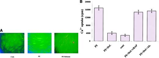 Fig. 7. Effect of α-defensin on PE-induced Ca++mobilization in human umbilical vein SMCs. / (A) SMCs were incubated in media with no additives (Cont.), or in the presence of 100 nM PE (PE) or 100 nM PE and 1 μM α-defensin (PE+Defensin) and photographed at 490 nm excitation and 520 nm emission. Original magnification × 40. (B) SMCs were incubated with buffer containing 45Ca++and 100 nM PE (PE); 100 nM PE and 1 μM α-defensin (PE+Def.);45Ca++ with no additives (cont); 100 nM PE, 1 μM defensin, and 20 nM rRAP (PE+Def.+rRAP); or 100 nM anti-LRP antibodies instead of rRAP (PE+Def.+Ab.).