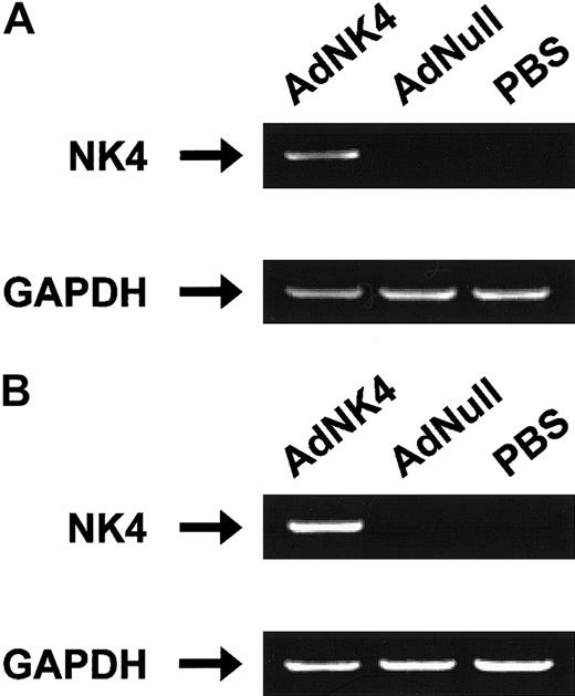 Fig. 1. In vitro and in vivo expression of AdNK4. / (A) Detection of AdNK4-mediated NK4 expression by RT-PCR in B16-F10 cells transduced with AdNK4. The generated cDNA from B16-F10 cells transduced with AdNK4, AdNull, or PBS alone at a multiplicity of infection of 100 for 3 days was amplified with primers for NK4 or GAPDH mRNA. (B) Detection of AdNK4-mediated NK4 expression by RT-PCR in B16-F10 tumors transduced with AdNK4. To demonstrate the expression of AdNK4 in vivo, C57Bl/6 mice were injected subcutaneously in the right flank with 3 × 105 B16-F10 cells (day 0). On day 8, tumor-bearing mice were treated by intratumoral injection of 109 pfu of AdNK4, AdNull, or PBS alone. On day 11, the generated cDNA from the transduced B16-F10 tumors was amplified with primers for NK4 or GAPDH mRNA. For both panels, PCR products were resolved in a 1% agarose gel and stained with ethidium bromide.