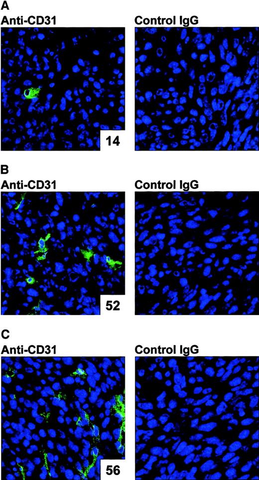 Fig. 2. Demonstration of the ability of AdNK4 to inhibit tumor vascularization. / For immunohistochemical evaluations for CD31, BALB/c mice were injected subcutaneously in the right flank with 2 × 105 Colon-26 cells (day 0). On day 8, tumor-bearing mice were treated by intratumoral injection of 109 pfu of AdNK4 (A), AdNull (B), or PBS alone (no transduction, C). On day 11, tumors were dissected, and frozen tumor sections were stained using 12.5 μg/mL rat anti–mouse CD31 antibody, or isotype-matched control rat IgG followed by visualization with FITC-conjugated anti–rat IgG antibody. Nuclei were stained with DAPI (original magnification × 400). The number of CD31+ vessels per 10 random high-power fields is indicated in the lower right corner of each left panel.