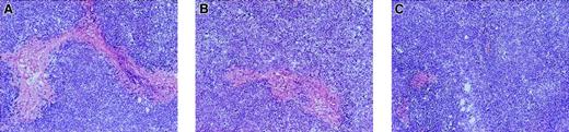 Fig. 3. Induction of tumor necrosis following intratumoral injection with AdNK4. / BALB/c mice with 8-day established subcutaneous Colon-26 tumors were treated with intratumoral injections of 109 pfu of AdNK4 (A), AdNull (B), or PBS alone (no transduction, C). Tumors were resected 3 days after injection, and frozen tumor sections were stained with H&E. Original magnification × 40.