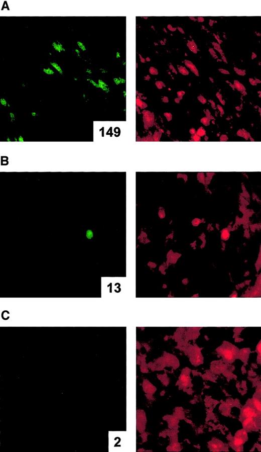 Fig. 4. In vivo analysis of apoptosis in Colon-26 tumors treated with AdNK4 using the TUNEL assay. / To demonstrate the apoptosis induced by AdNK4 in vivo, BALB/c mice were injected subcutaneously in the flank with 2 × 105Conlon-26 cells (day 0). On day 8, tumor-bearing mice were treated by intratumoral injection of 109 pfu of AdNK4 (A), AdNull (B), or PBS alone (no transduction, C). On day 11, tumors were dissected, and in frozen tumor sections, the fragmented DNA of apoptotic cells were labeled by fluorescein-12–uridine triphosphate (UTP) incorporation at 3′-OH DNA ends. Following terminal transfer of fluorescein-12–UTP, sections were counterstained with propidium iodide (PI). Each fluorescent image was viewed for fluorescein (green fluorescence shown in the left panel) and PI (red fluorescence shown in the right panel). AdNK4-transduced tumors had some apoptotic cells, whereas control tumors (ie, AdNull-transduced and nontransduced tumors) had minimal apoptotic cells. Original magnification × 400. The number of apoptotic cells per 10 random high-power fields is indicated in the lower right corner of each left panel.