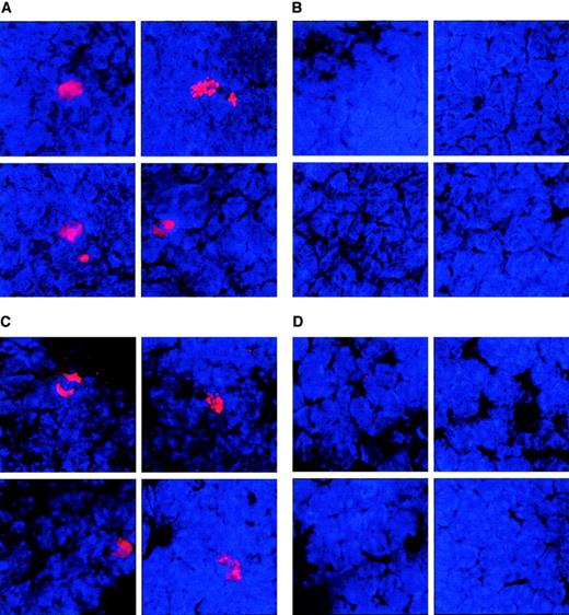 Fig. 10. Demonstration of the ability of intratumorally inoculated DCs to traffic to the spleen. / BALB/c mice with 8-day established subcutaneous Colon-26 tumors received injections of AdNK4 (A) or AdNull (C) followed by the injection of PKH26 (red fluorescence)–labeled DCs on day 11, or received injections of AdNK4 followed by the injection of PBS (B). Controls included untreated tumor-bearing mice (D). Spleens were dissected 3 days after the last treatment, and the frozen spleen sections were examined with a fluorescence microscope. In all panels, nuclei were stained with DAPI (blue fluorescence). Original magnification × 400.