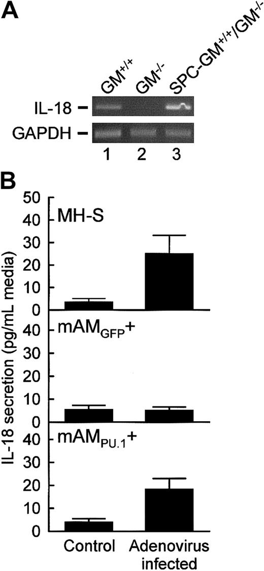 Fig. 4. IL-18 expression in AMs from GM−/− mice is severely impaired but was restored by retrovirus-mediated expression of PU.1. / (A) Primary AMs from GM+/+, GM−/−, and SPC-GM+/+/GM−/− mice were assessed for the presence of mRNA transcripts encoding IL-18 or GAPDH, as a control to demonstrate evaluation of equal amounts of total RNA, using RT-PCR as described in “Materials and methods.” Photographs of ethidium bromide–stained agarose electrophoresis gels of the PCR products are shown. Each lane represents AMs from one mouse. The experiment was repeated twice with the same results. (B) Cultured AMs were exposed to adenovirus (Adenovirus infected) or not exposed (Control) for 24 hours, and then IL-18 release into the medium was quantified by ELISA as described in “Materials and methods.” The sensitivity of detection of IL-18 was 5 pg/mL. Data represent means ± SEM; n = 3 to 6 (uninfected) or 4 to 10 (infected). Differences in IL-18 release by adenovirus-infected and uninfected MH-S and mAMPU.1+ cells were significant (P < .03). IL-18 release by adenovirus-infected and uninfected mAMGFP+ cells was not significantly different (P = .88).