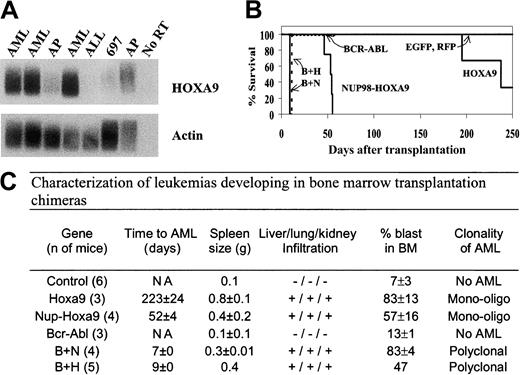 Fig. 2. NUP98-HOXA9 and HOXA9genetically interact with BCR-ABL to acutely transform bone marrow cells. / (A) Semiquantitative RT-PCR analysis demonstrates high levels ofHOXA9 in cells obtained from CML patients at diagnosis of myeloid blast transformation (lanes 1, 2, 4; AML) and low levels in cells from patients in the accelerated phase (AP; pre-AML) of their disease (lanes 3 and 7). Note that HOXA9 is not expressed in acute lymphoblastic leukemias (ALLs); 697 is a pre-B ALL cell line. “No RT” indicates the absence of reverse transcriptase in the reaction. Probe used as indicated, exposure time: 4½ hours for HOXA9 and 2½ hours for actin. (B) Survival curve of recipients of 2 × 105 (day-0 equivalent) BM cells transduced with the indicated retrovirus and grown prior to transplantation for 7 days in vitro with hemopoietic growth factors; “B” refers toBCR-ABL; “H,” to HOXA9; and “N,” toNUP98-HOXA9. (C) Characteristics of leukemias developing in the various bone marrow transplantation chimeras described in panel B. AML, acute myeloid leukemia; % blast evaluated on 100 cells per each mouse. NA indicates data not available.