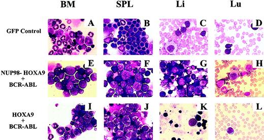 Fig. 3. Morphological analysis of leukemic and myeloproliferative diseases occurring in the various transplantation chimeras. / Cytological analysis of bone marrow (BM), spleen (SPL), liver (Li), and lung (Lu) from recipients of bone marrow cells infected with the indicated retroviruses. Cytospins were prepared and stained as described.6 Original magnifications × 40.