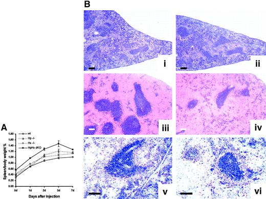 Fig. 4. Analysis of the spleen under basal conditions and after acute hemolysis. / (A) Spleen/body weight percent in wild-type, Hp-null, Hx-null, and HpHx dKO mice subjected to φhyd-induced hemolysis. Mice were injected with 0.15 mg/g body weight of φhyd. Values represent means ± SEM. At least 5 animals at each time point were analyzed. Differences between wild-type and HpHx dKO mice were significant at each time point (P < .001). Differences between wild-type and single KO mice became significant from day 2 (P < .001). (B) Spleen sections of 2 wild-type (i,iii,v) and 2 HpHx dKO (ii,iv,vi) mice before (i-ii) and one day after φhyd injection (iii-vi) stained with hematoxylin and eosin (i-iv) and processed by immunohistochemistry with an anti–HO-1 antibody (v-vi). Note the stronger red blood cell accumulation in the HpHx dKO mouse than in the wild-type mouse after φhyd treatment, but no differences in HO-1 expression. Scale bars: i-iv, 250 μm; v-vi, 200 μm.