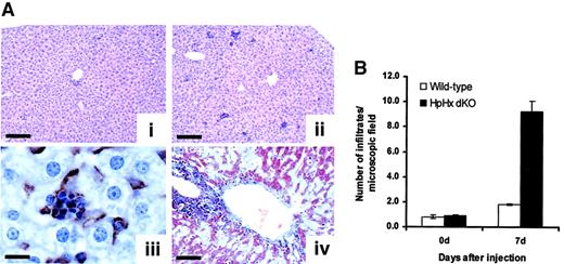 Fig. 6. Analysis of the liver 7 days after acute hemolysis. / (A) Liver sections of a wild-type (i) and 2 HpHx dKO mice (ii-iv) 7 days after φhyd injection stained with hematoxylin and eosin (i-ii), processed by immunohistochemistry with an anti-F4/80 antibody (iii) and stained with the Masson trichrome reaction (iv). Several leukocyte infiltrates were evident in the HpHx dKO mouse (ii). These infiltrates were strongly F4/80 positive (iii). The animal in panel iv showed massive hepatic injury with extensive fibrosis. Scale bars: i-ii, 200 μm; iii, 20 μm; iv, 100 μm. (B) Number of macrophage infiltrates per microscopic field in wild-type and HpHx dKO mice under basal condition and 7 days after φhyd injection. Macrophage infiltrates were counted on hematoxylin-and-eosin–stained sections as reported in “Materials and methods.” Four mice of each genotype were analyzed at each time point. At 7 days,P < .02.